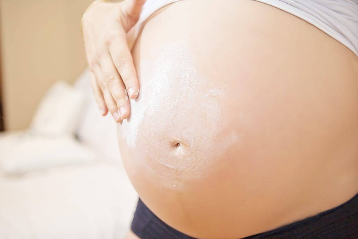 How to Prevent Pregnancy Stretch Marks